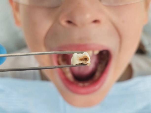 Best Broken Tooth Emergency  in Chico, CA